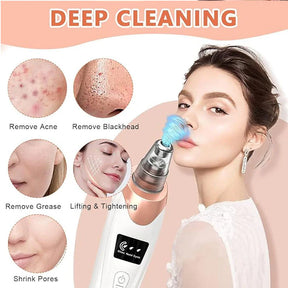 5 in 1 Black Head Remover machine, Powerful Pimple Pore Cleaner, Vacuum Suction Tool